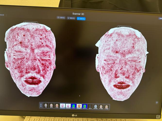 美容针在线观看风险多，画质模糊别轻信